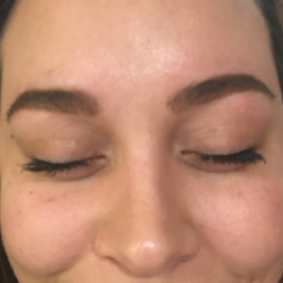Close-up of clear skin around the eyes after Marin Skincare treatment