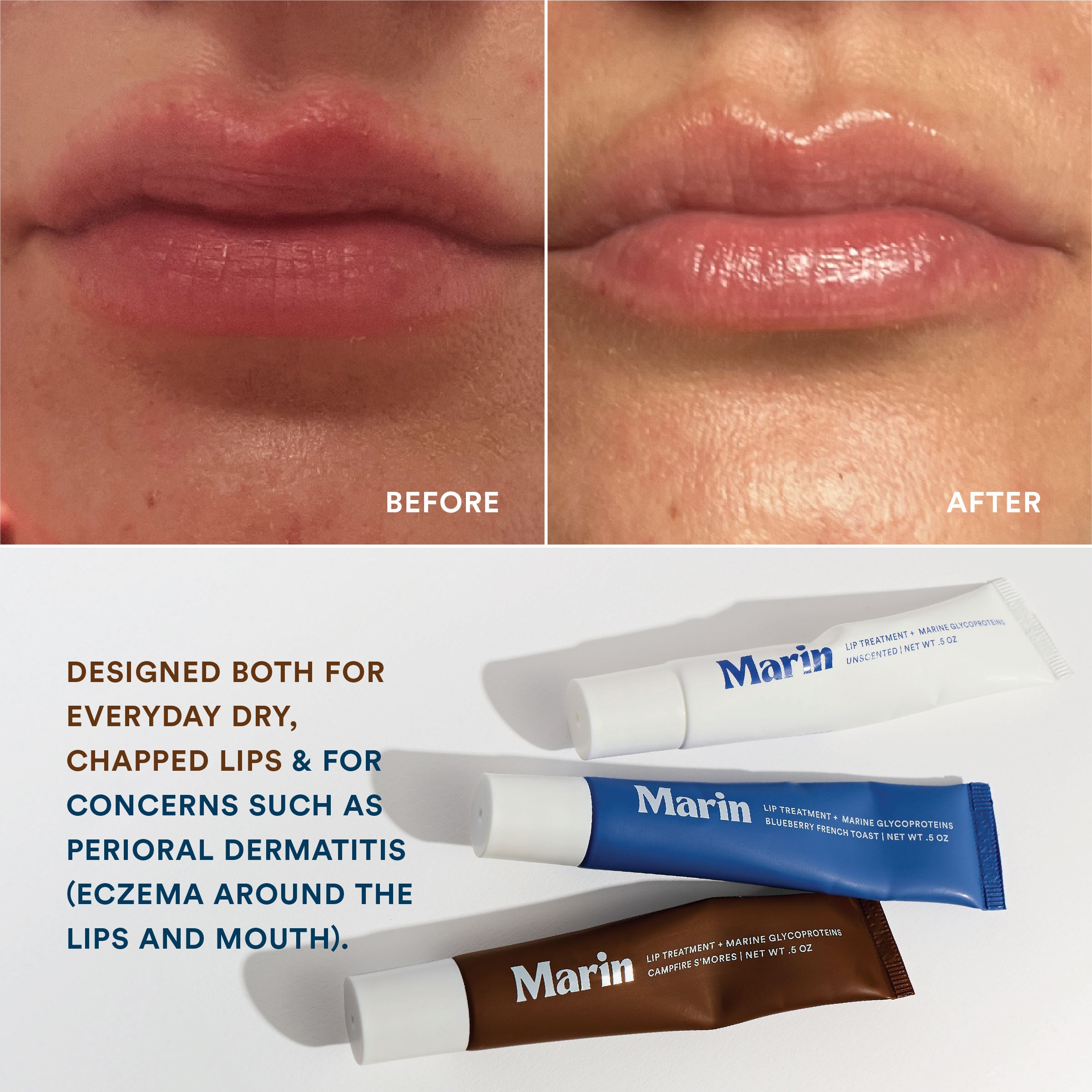 Lip Triple – Marin Skincare