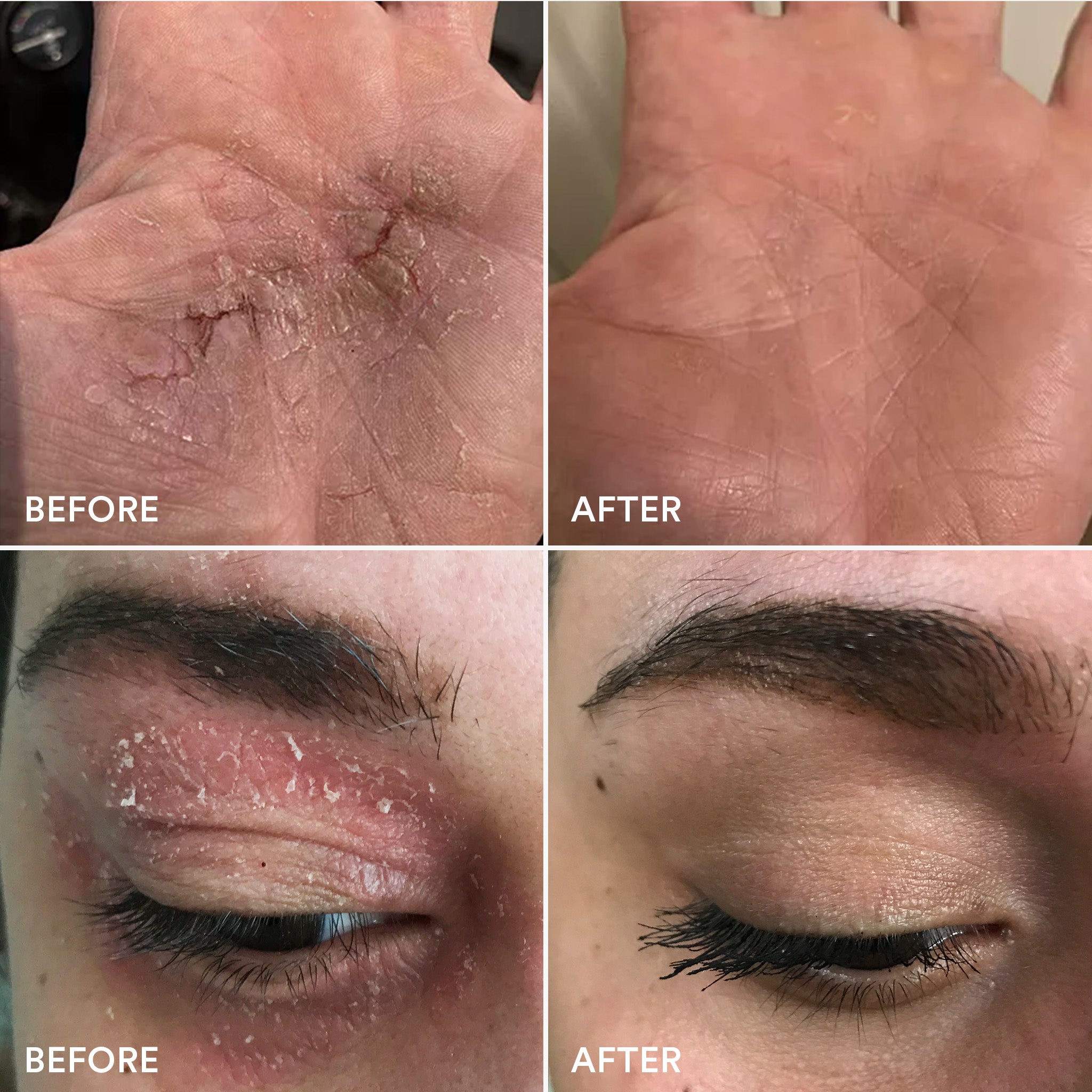 Soothing Hydration Cream