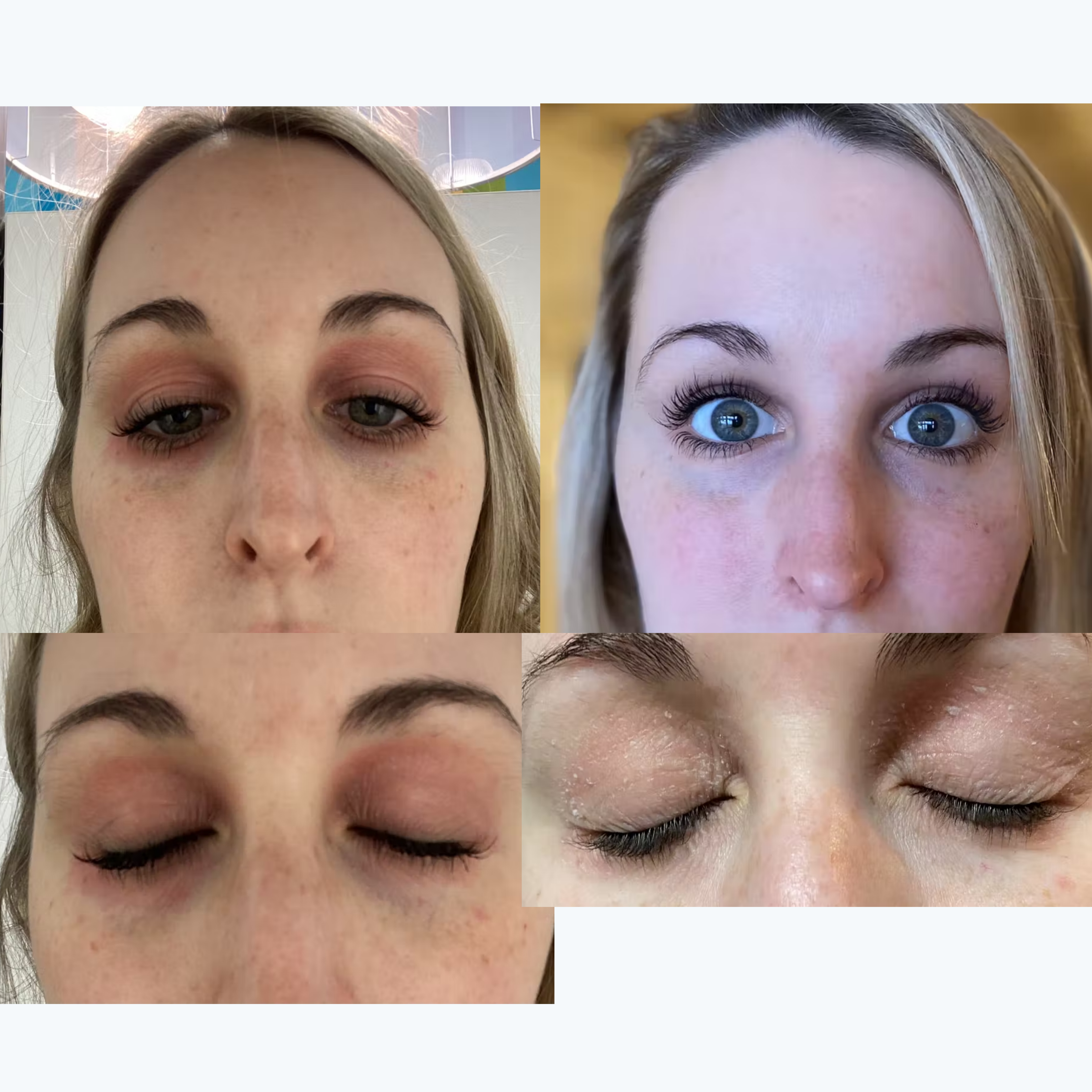 Four close-up before-and-after photos of Jess's eyes and lashes; caption: "Life changing!" - Jess