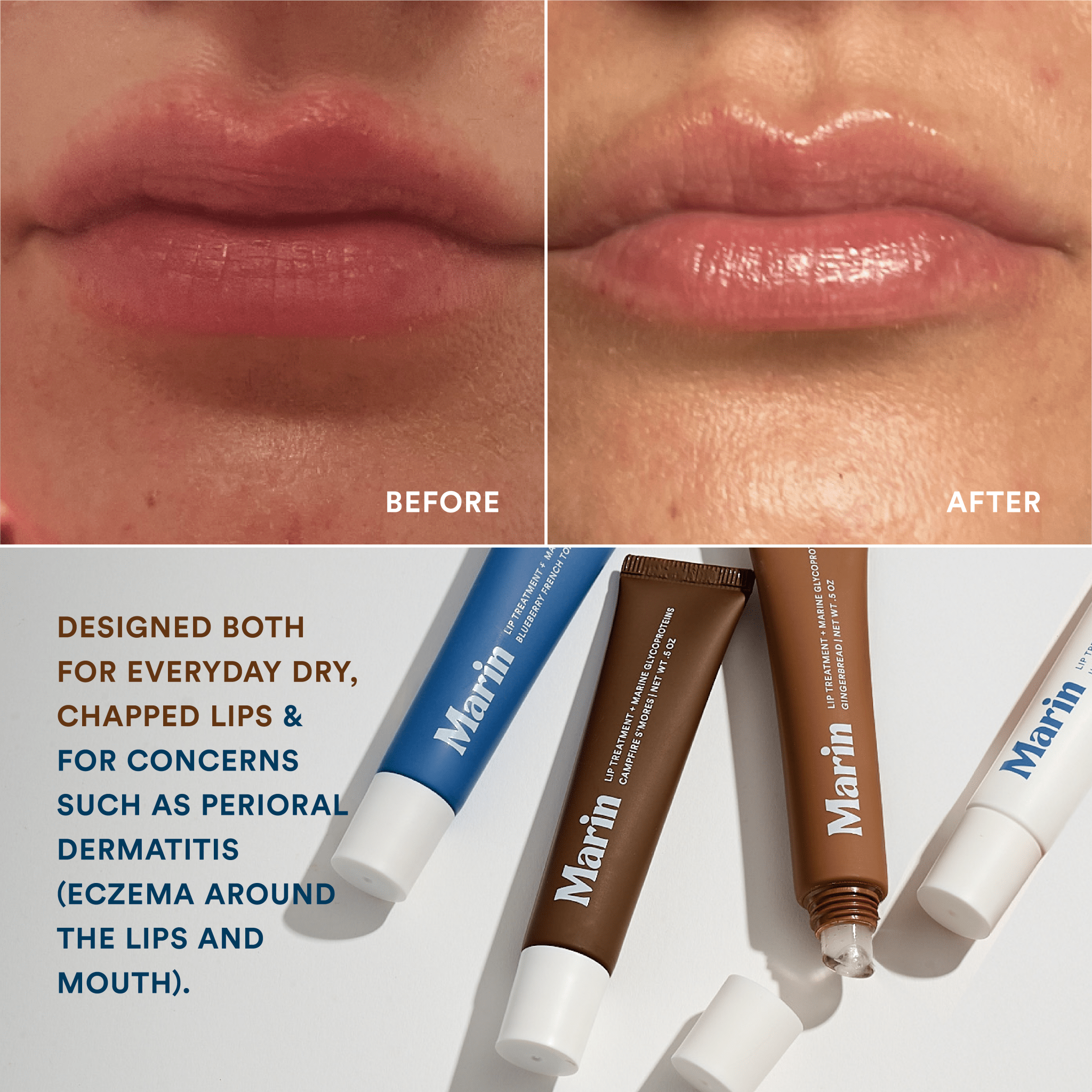 Lip Triple - Marin Skincare - 