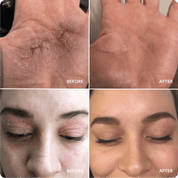 Marin Skincare before-and-after photos showing dry hand and eyelid improvement; images labeled BEFORE and AFTER.
