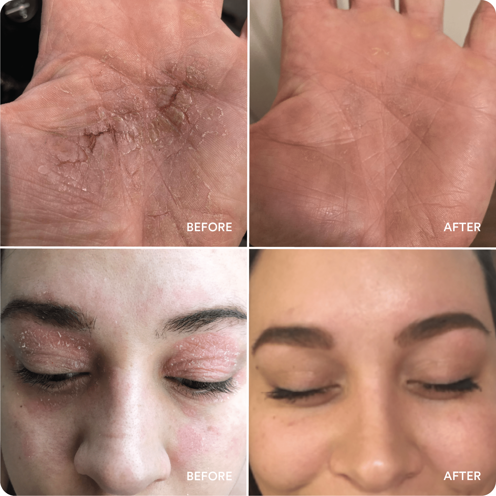 Marin Skincare before-and-after photos showing dry hand and eyelid improvement; images labeled BEFORE and AFTER.