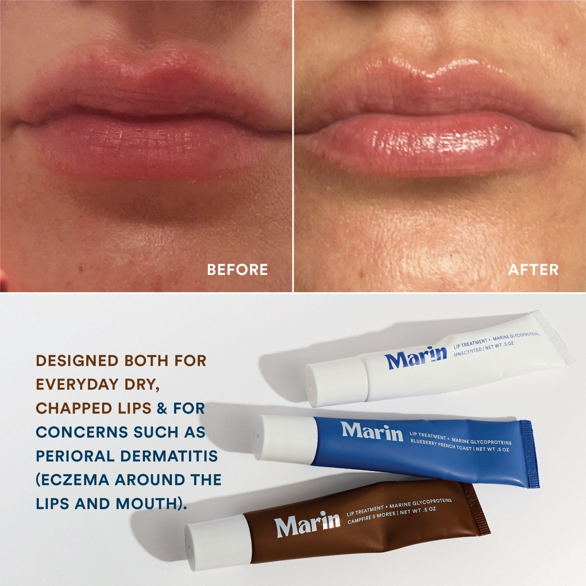 Soothing Hydration + Lippie Bundle – Marin Skincare